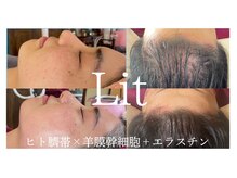 リラスル(Rela x Suru)