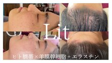 リラスル(Rela x Suru)