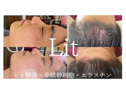 リラスル(Rela x Suru)の写真