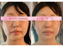 ウルワシ(Uruwashi)の雰囲気（　【左右差改善♪♪】　無料駐車場完備しております）