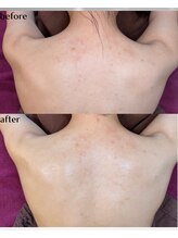 ヒーリングハーツ(Healing Hearts)/ボディーメンテナンス！/清水町/