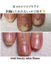 カンナ(Kanna)/5500円