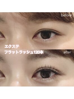 レディエント(Radiant)/フラットラッシュ120本