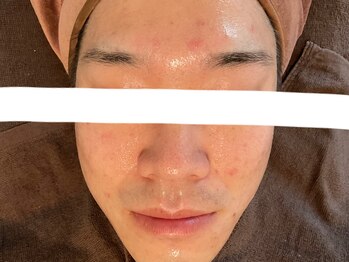 リセットプラス(Reset+)/