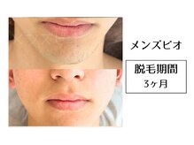 メンズビオ 神戸三宮店/