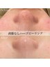【鼻の黒ずみ・皮脂ケア付き★】REVI陶肌ハーブピーリングお試し￥11,000