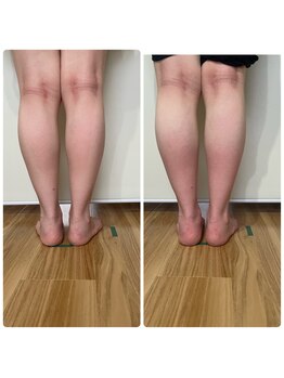 ヨサパーク シピ(YOSAOARK Chipie)/水素フットバス