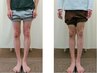 男性限定【O脚/がに股/姿勢改善】★初回限定¥4,980