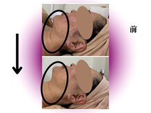 カリアンヌ/ローズ蒸しテント&フェイシャル