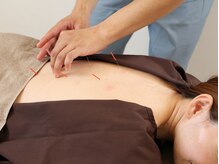 リターズ鍼灸治療所 天王寺院の雰囲気（はり・低周波機器・電気を流すはり/コリをほぐす/血流促進/冷え）