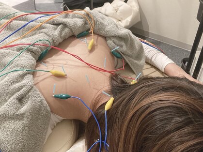 アウン(aum)の写真