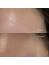 ユニ(uni)/face wax