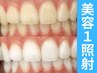 【会員/回数券】8分×4回美容セルフホワイトニング