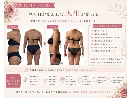 ヨサパーク ヴィータローザ 水戸赤塚店(YOSA PARK Vita Rosa)の写真
