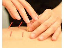 グッドバランス 学芸大学(Good Balance)/【メニュー】鍼施術×整体　