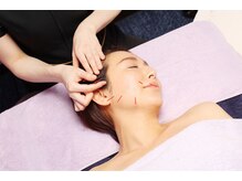 シー バイ カリスタ 渋谷店(C by CALISTA)/肌の負担を最小限にした美容鍼