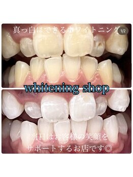 ホワイトニングショップ 柏店/美白ホワイトニング