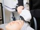 マウム(MAUM)の写真/【新導入！ハイパワー美肌脱毛】お顔の産毛・毛穴の開き・くすみをケア◎透明感のある美肌に導きます♪