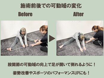 ストレッチリヴェラ(STRETCH LIVERA)/【開脚の可動域の変化】