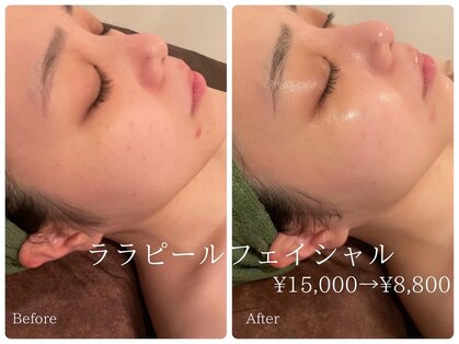 エステサロン ジュエル 高松レインボー店(JEWEL)の写真