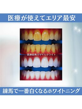 スマイルホワイト 練馬店の写真/初めての方にオススメ！歯が真っ白なホワイトニングアドバイザーが丁寧にサポートしながらホワイトニング♪