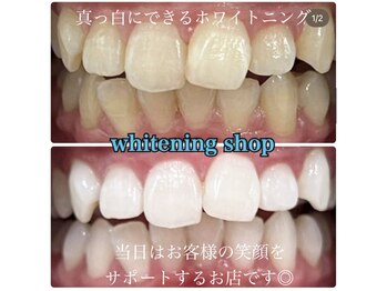 ホワイトニングショップ 柏店/美白ホワイトニング