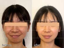 エビアス(Evias)/変化に感動♪極上エイジングケア