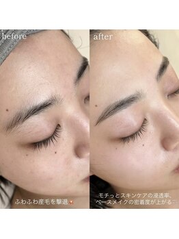 アノン(ANNON.)の写真/《自社メーカー開発WAXプロダクトでお肌の負担を最小限に艶水光肌に》劇的艶肌&最高のお化粧ノリを体感！