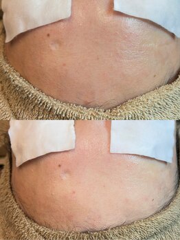 アトレ(Atre)/ゾンビエステ★