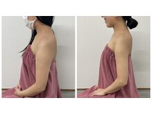 ブリランテ(Brillante)/ブライダル3回目