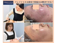 浜松富塚ベルミーランド