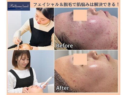 浜松富塚ベルミーランドの写真