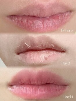 ローマピンク 札幌/ローマピンクリップ★