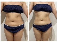 ボディケアアップ(BODY CARE UP↑)の雰囲気（内側から整えるWINBACK☆回数を重ねるごとに変化を実感。）