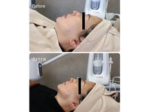 フロラスキン 横浜店(florasKIN)の雰囲気（【フローラ肌質改善｜しわ・たるみ】ハリ＆弾力UP｜リフトUP♪）