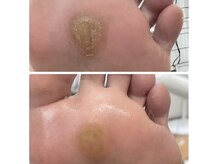 エクラプラス(Eclat.plus)の雰囲気（フットケア・角質ケア・巻き爪ケア・深爪ケア）