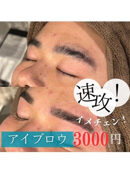 フラン(franc)/