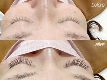 バランス 泉中央店(balance)/バインドロック/付け放題