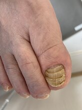 足楽 京都御池店/お爪が段々に