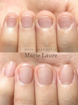 マリーロール 淀屋橋本店(Marie Laure)/自爪育成/深爪矯正/ネイルケア