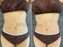 インディバ サロン S/お客様 Before→After