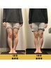 【下半身太り/むくみ】女性のお悩みNo.1！O脚改善で華奢な下半身・美脚に★