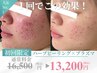 【肌育☆人気No1】ハーブピーリング＋プラズマデコルテ付120分¥16500→¥13200