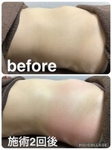 ギンザアール(GINZA R.)/ぽっこりお腹に徹底アプローチ◎