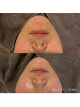 エクラ(eclat)/セルクラ