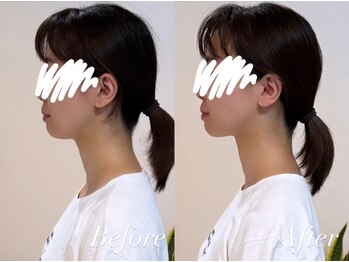 ハクト(Hakuto)/Before/After