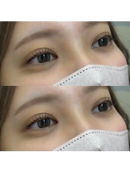 ソリン(Solin')/まつげパーマ