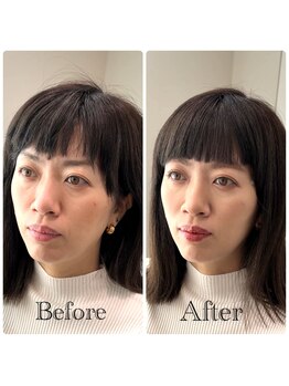 シャルム(Sharme)/お客様Before→After