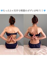 ルーモアンド(Lumo&)/ブライダルエステ