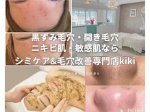 毛穴の種類は様々…どんな毛穴悩みにも対応◎定額で提供します♪